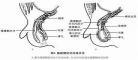 腹股沟在哪个位置图片